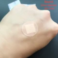 skin diameter 22mm