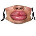 Swollen