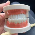 Dental Mold