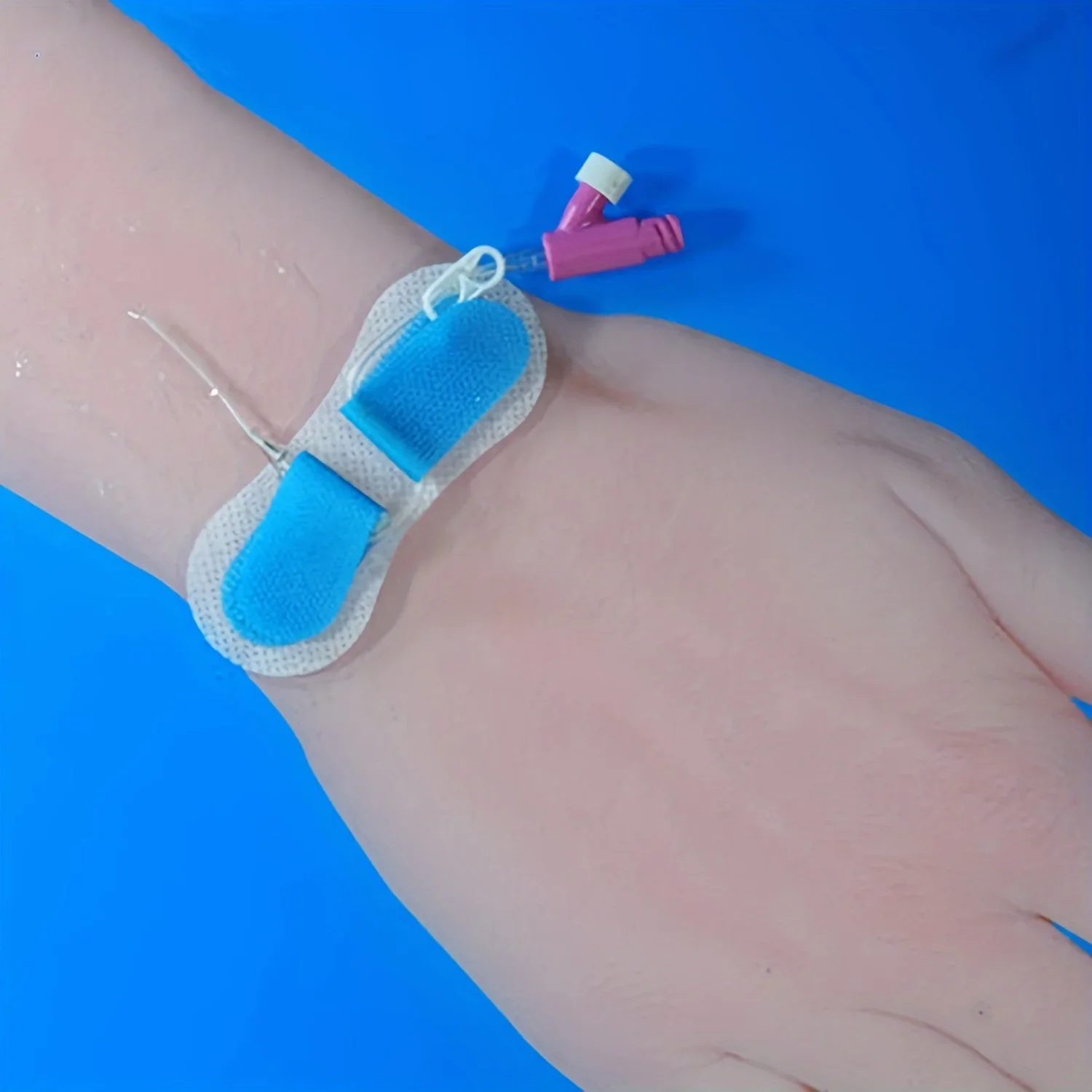 Dispositivo de fijación de catéter PICC/CVC, adecuado para agujas de inducción a largo plazo, facilita el doblado del catéter - imagen 5