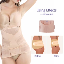 Sunveno Faja posparto 3 en 1 – Cinturón de recuperación abdominal
