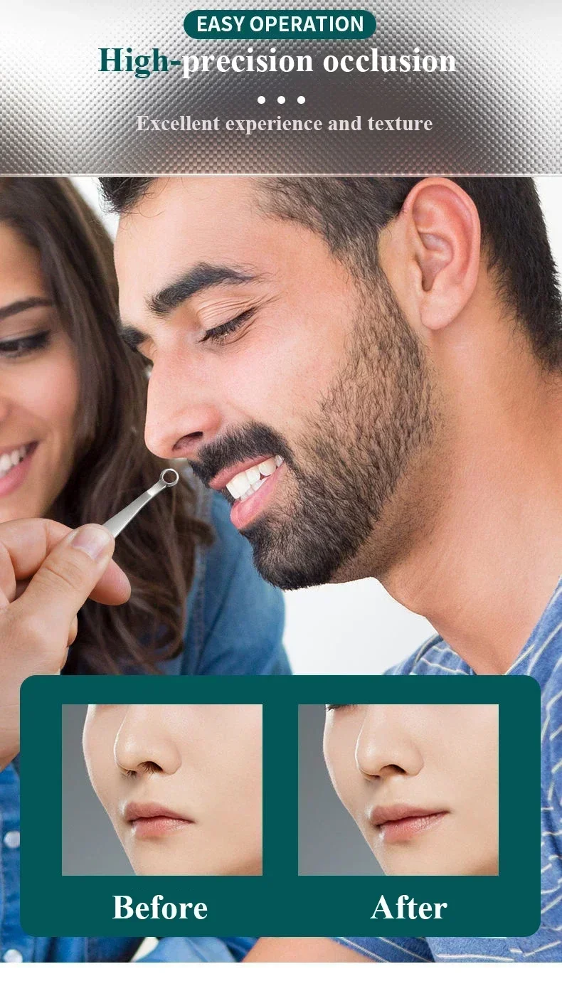 Detalle de pinzas universales