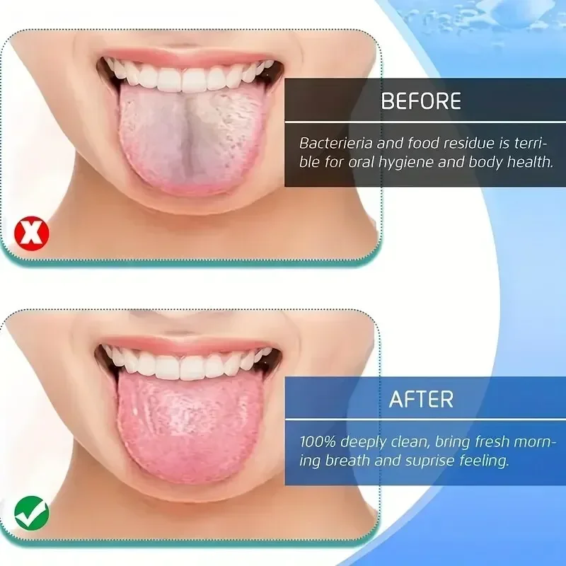 Raspador de lengua de acero inoxidable en U para aliento fresco