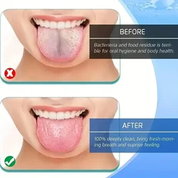 Raspador de lengua de acero inoxidable en U para aliento fresco
