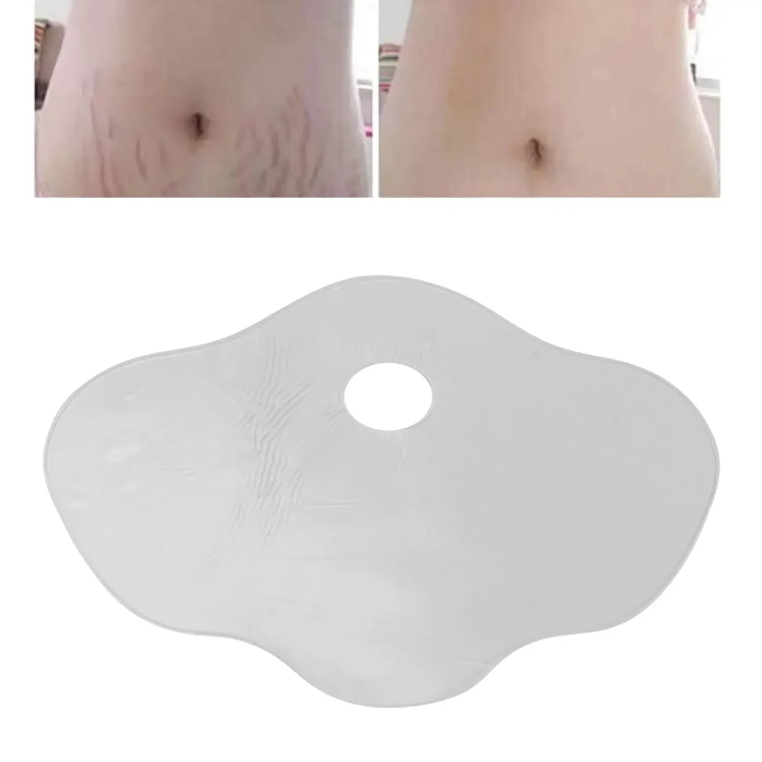 Tiras de silicona para estrías y cicatrices – Reutilizables - imagen 5