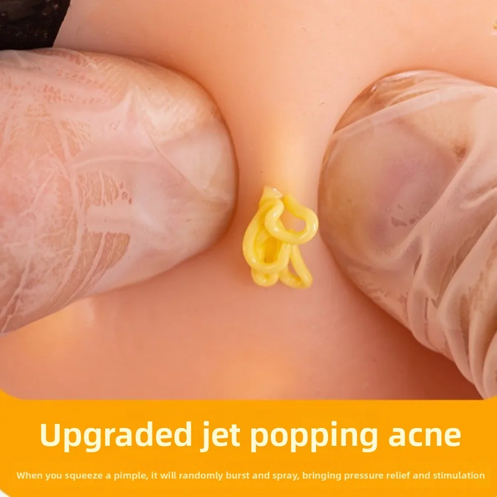 Juguete sensorial antiestrés de espinillas rellenable realista - imagen 4