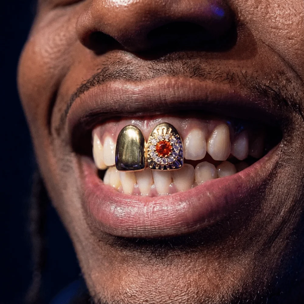 Proceso de colocación del grillz con silicona