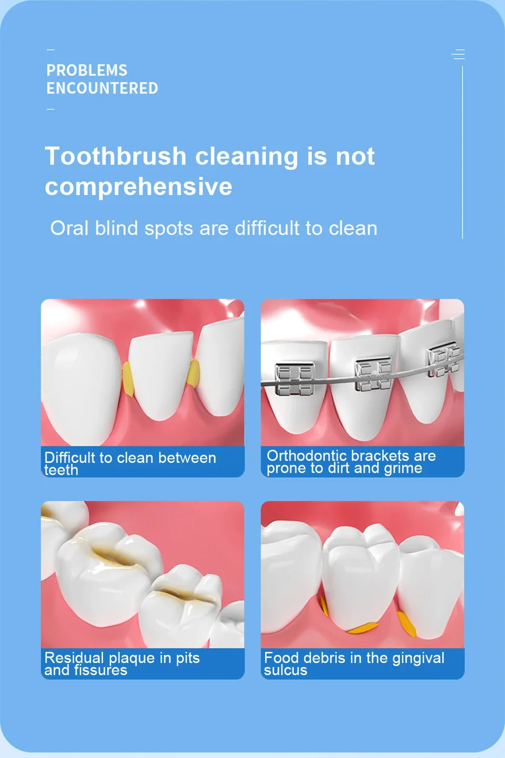 Limpieza dirigida entre dientes y ortodoncia