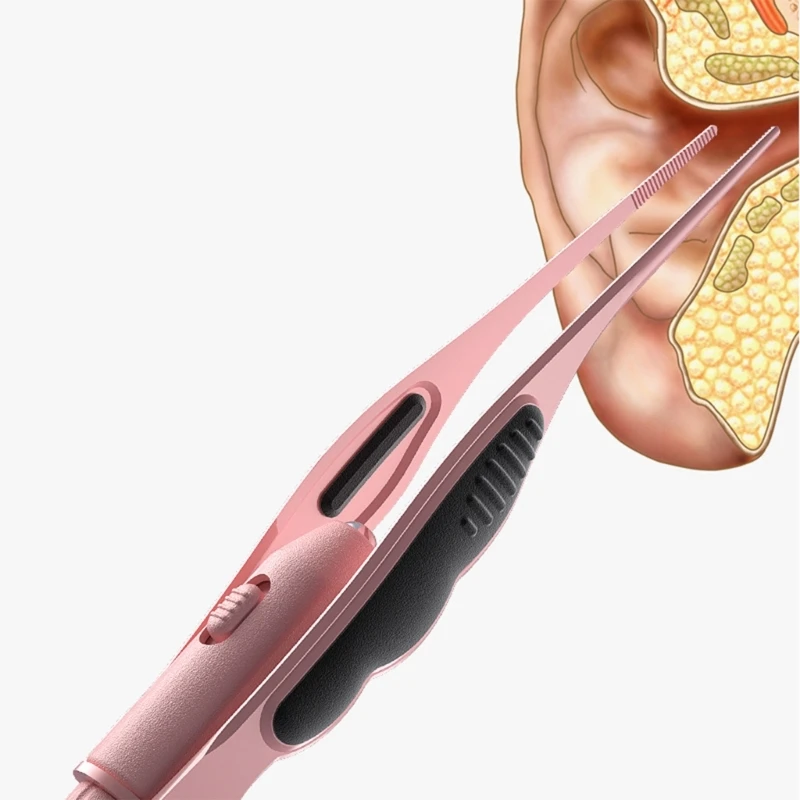 Pinza LED para extraer cerumen auricular – Herramienta con luz de seguridad