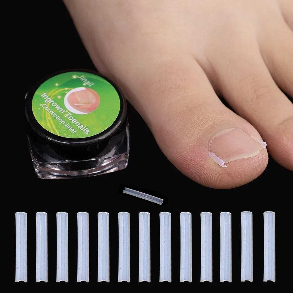 Corrector de uñas encarnadas con parches adhesivos elásticos - imagen 4