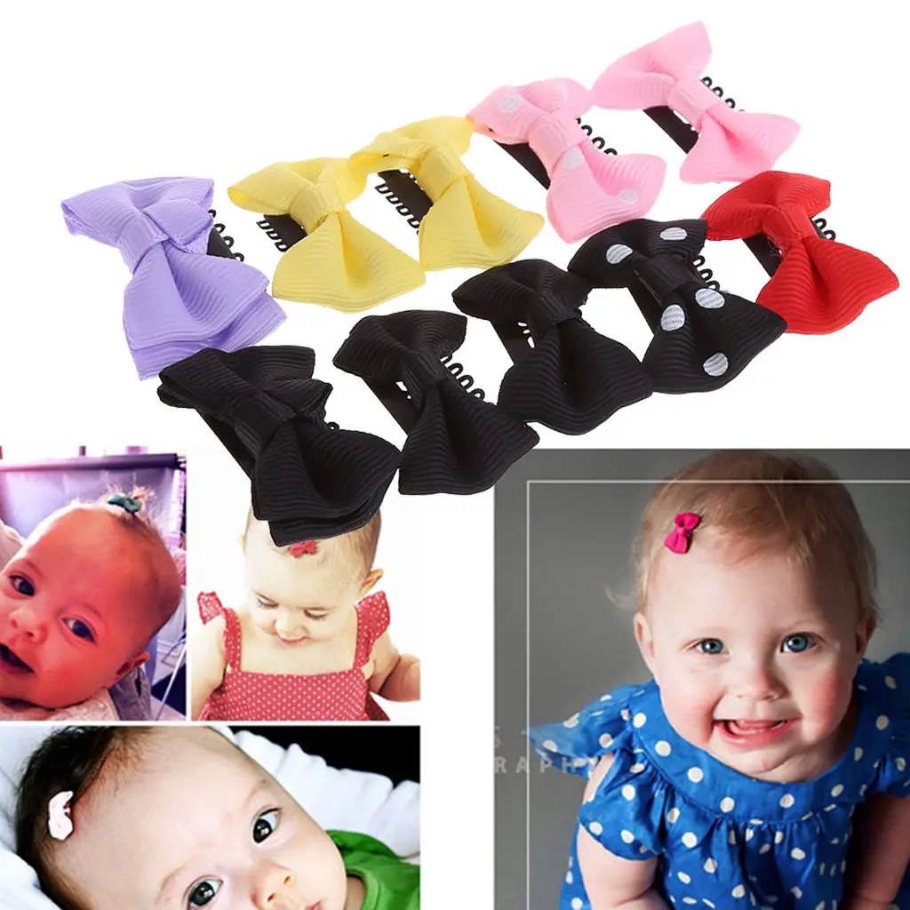 Detalle de horquillas infantiles con estampado de puntos