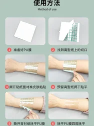 Parches impermeables transparentes – Apósitos grandes para heridas